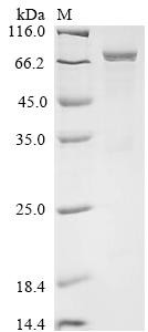 Eosinophil peroxidase (EPX), human, recombinant