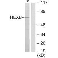 Anti-HEXB