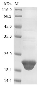 Histone H3.1 (HIST1H3A), partial, human, recombinant