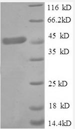 Tumor necrosis factor receptor superfamily member 1A (TNFRSF1A), partial, human, recombinant