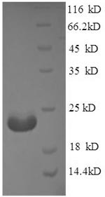 Adiponectin (Adipoq), partial, mouse, recombinant