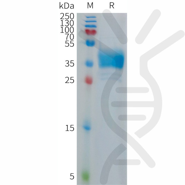 Human CHRM2 Protein, hFc Tag