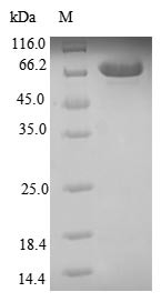 Carbonic anhydrase 9 (CA9), partial, human, recombinant