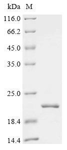 C5a anaphylatoxin chemotactic receptor (C5AR1), partial, human, recombinant