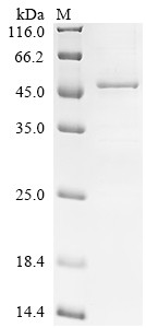 Acetyl-CoA acetyltransferase,mitochondrial (ACAT1), human, recombinant