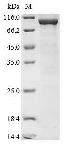 DNA polymerase theta (POLQ), partial, human, recombinant