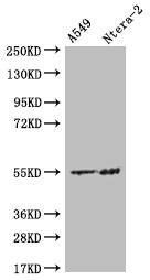 Anti-HMGCS2 Recombinant Monoclonal, clone 19C11