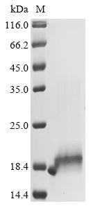 Protein S100-B (S100b), mouse, recombinant