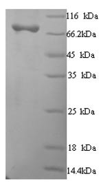 Macrophage mannose receptor 1 (MRC1), partial, human, recombinant