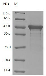 Eukaryotic translation initiation factor 4 gamma 1 (EIF4G1), partial, human, recombinant