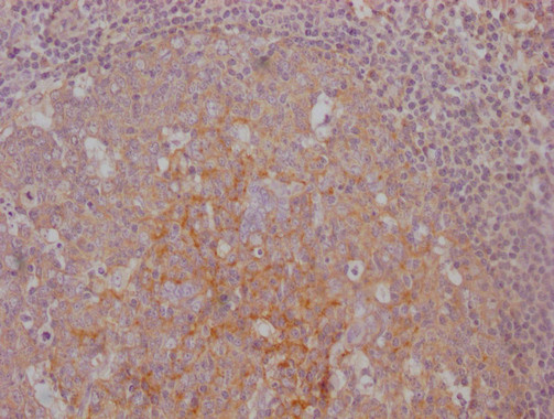 Anti-CD14 Monoclonal