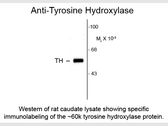 Anti-Tyrosine Hydroxylase