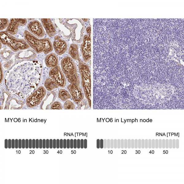 Anti-MYO6