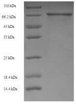 Ig gamma-1 chain C region (IGHG1), human, recombinant