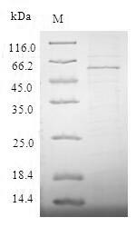 Metalloreductase STEAP1 (STEAP1), human, recombinant