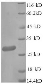 Scavenger receptor cysteine-rich type 1 protein M130 (Cd163), partial, mouse, recombinant