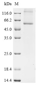 O-acyltransferase (DGAT1-2), Zea mays, recombinant