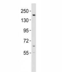 Anti-KDM6B