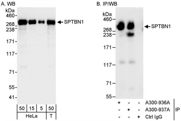 Anti-SPTBN1