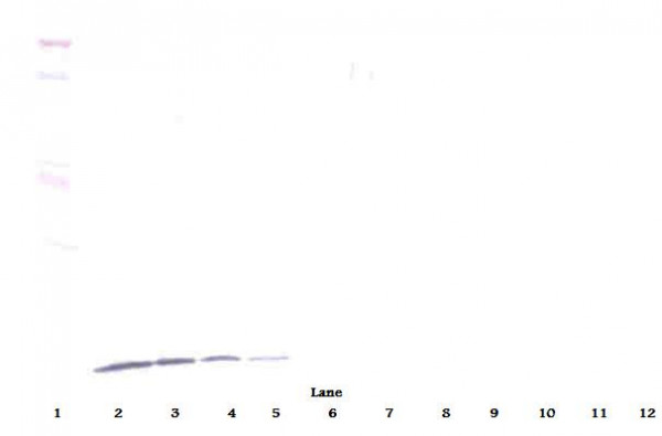 Anti-CXCL10 / IP10, clone 3.3-1G1-2G7-2F6