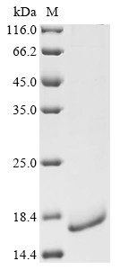 C-C chemokine receptor type 2 (Ccr2), partial, mouse, recombinant