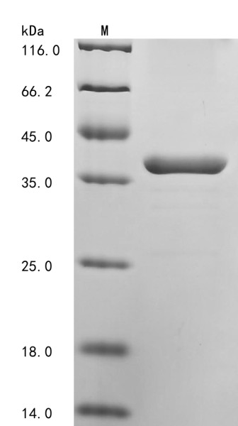 Transferrin receptor protein 1 (Tfrc), partial, rat, recombinant