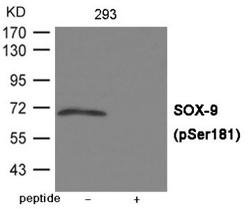 Anti-Phospho-SOX9 (Ser181)