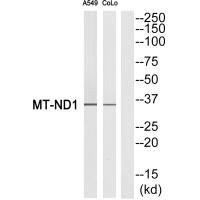 Anti-MT-ND1