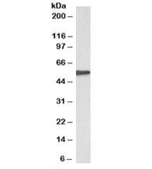 Anti-EPHX2Antibody