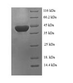 Carbonic anhydrase 1 (Ca1), rat, recombinant