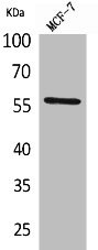 Anti-ACVRL1