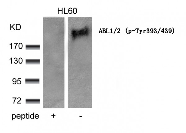 Anti-phospho-ABL1/2 (Tyr393/439)