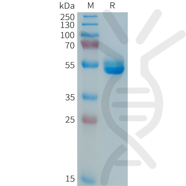 Human PRL Protein, hFc Tag