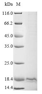 Oxytocin-neurophysin 1 (OXT), partial, human, recombinant