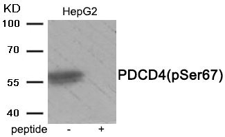 Anti-Phospho-PDCD4 (Ser67)