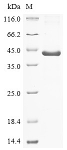 Lysine-specific demethylase 6B (KDM6B), partial, human, recombinant