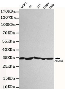 Anti-ANXA5