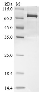 Poly [ADP-ribose] polymerase 2 (PARP2), human, recombinant