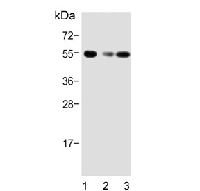 Anti-ACVR1B / Activin receptor type-1B / ALK4