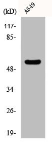 Anti-CHST2