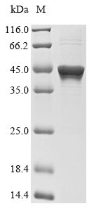 Tyrosine-protein phosphatase non-receptor type 1 (PTPN1), partial, human, recombinant