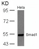 Phospho-Smad1 for Activation/Inhibition site Antibody Panel