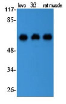 Anti-HSP60