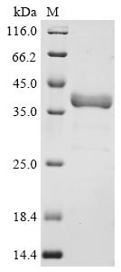 Fructose-bisphosphate aldolase C (ALDOC), human, recombinant