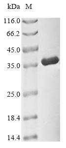 Cyclin-dependent kinase 1 (CDK1), human, recombinant