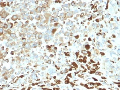 Anti-NGF-Receptor (p75) / CD271 (Soft Tissue Tumor Marker) (NGFR/2550R), CF640R conjugate, 0.1mg/mL