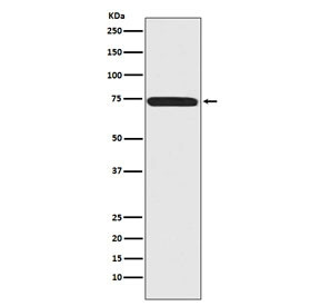 Anti-Menin / MEN1, clone ACBA-13