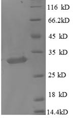 Metallothionein-1X (MT1X), partial, human, recombinant