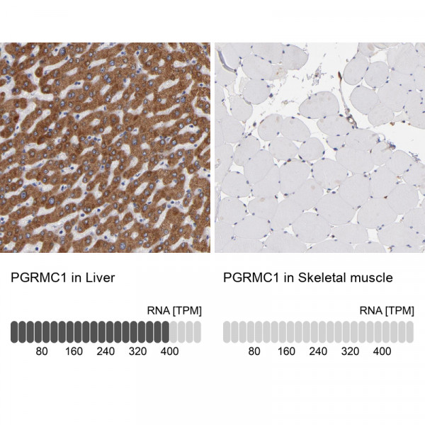 Anti-PGRMC1