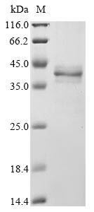 HLA class I histocompatibility antigen, A alpha chain (HLA-A),partial, human, recombinant